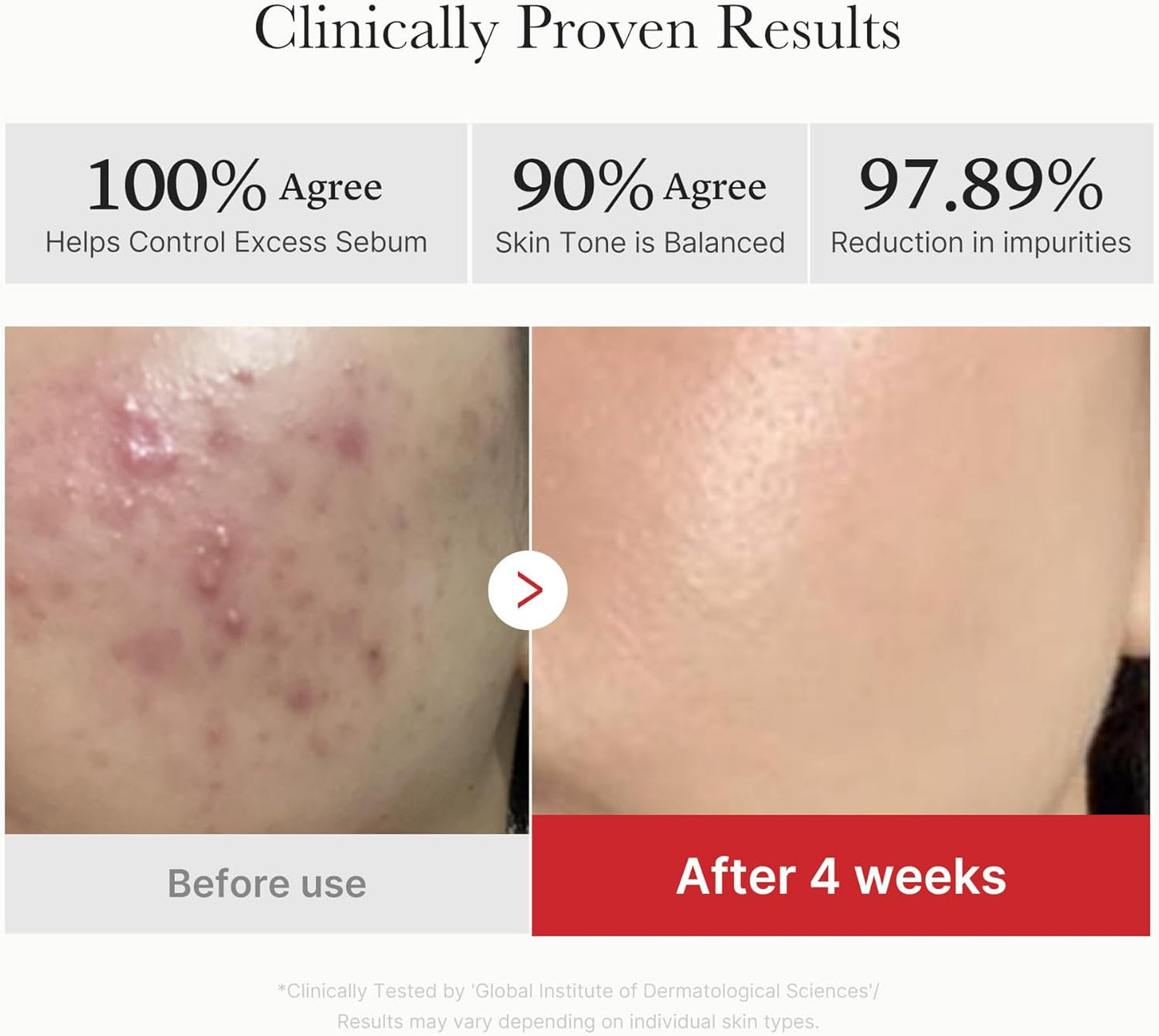 Medicube – Red Succinic Acid Panthenol Pads (Akne, Leke ve Kızarıklık Karşıtı Süksinik Asitli Tonik Pedler)